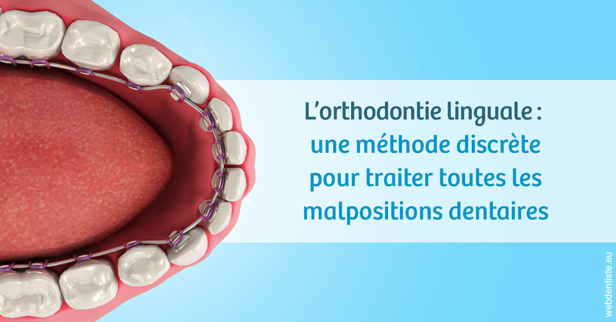 https://dr-rohr-marc.chirurgiens-dentistes.fr/L'orthodontie linguale 1