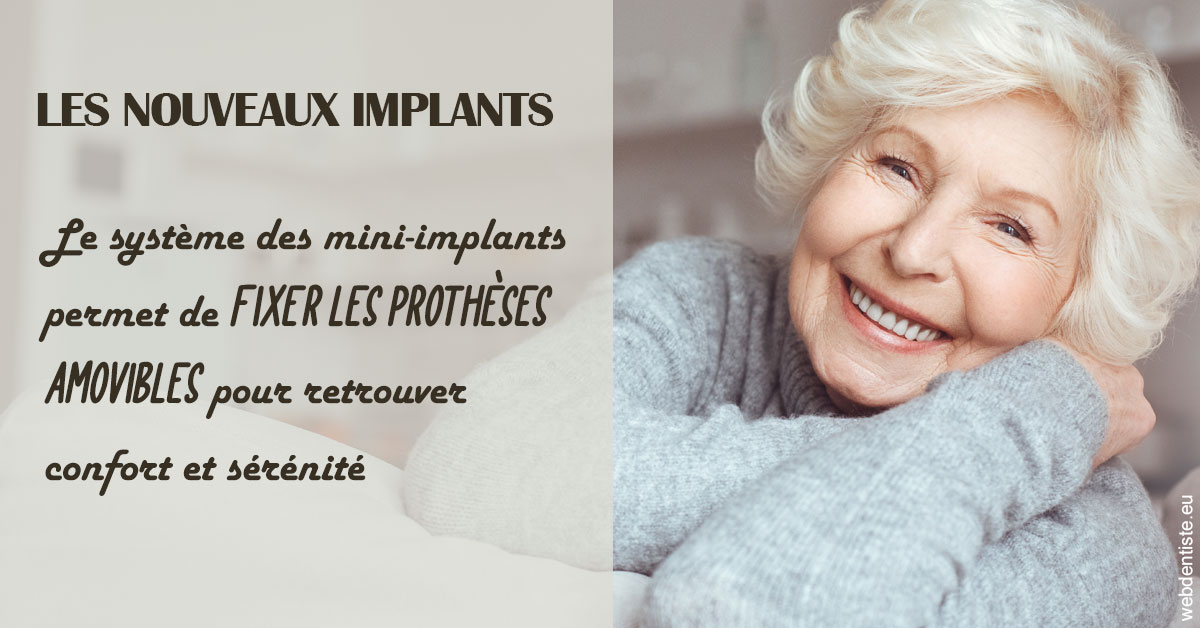 https://dr-rohr-marc.chirurgiens-dentistes.fr/Les nouveaux implants 1