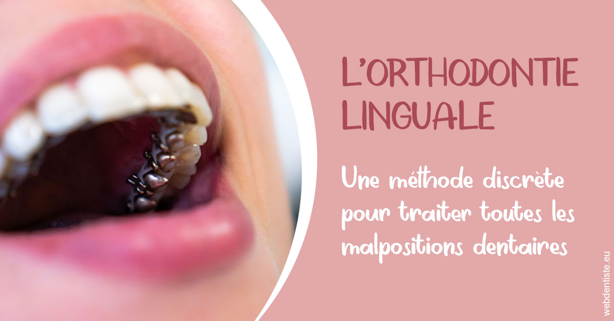 https://dr-rohr-marc.chirurgiens-dentistes.fr/L'orthodontie linguale 2