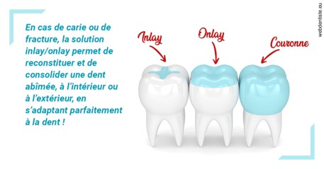 https://dr-rohr-marc.chirurgiens-dentistes.fr/L'INLAY ou l'ONLAY