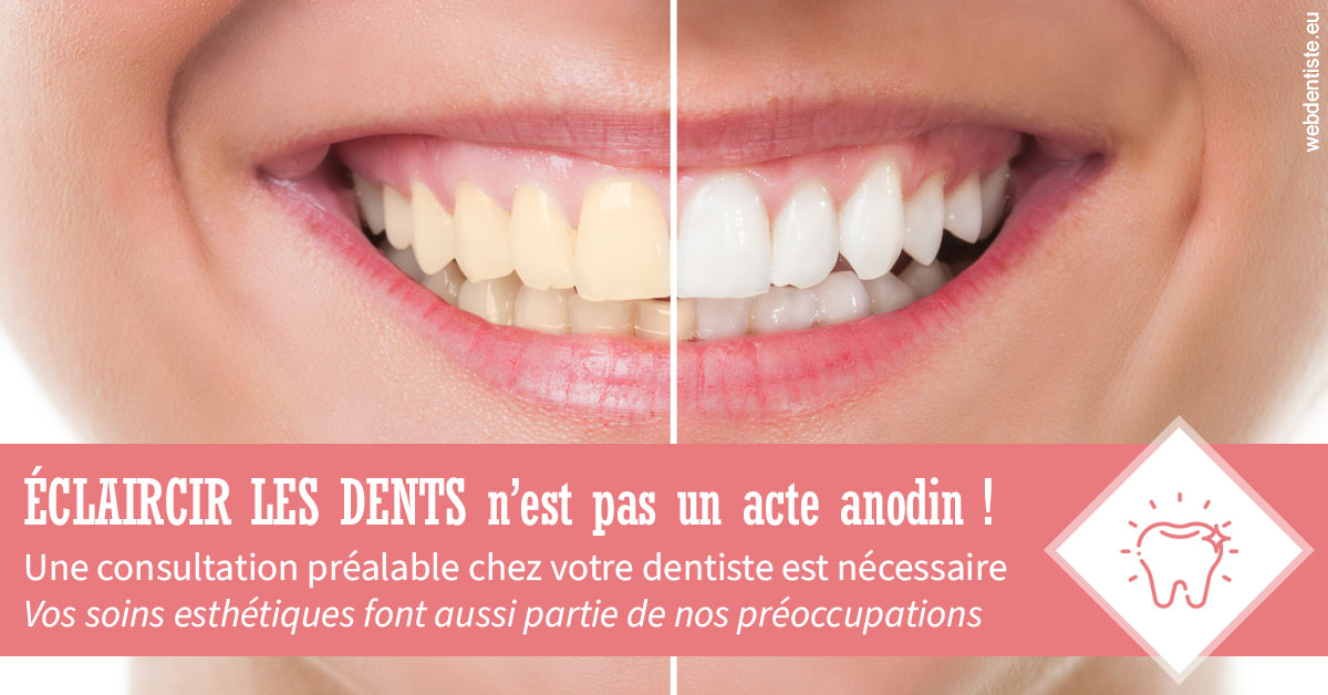 https://dr-rohr-marc.chirurgiens-dentistes.fr/Eclaircir les dents 1