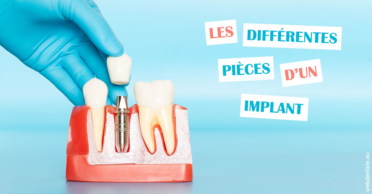 https://dr-rohr-marc.chirurgiens-dentistes.fr/Les différentes pièces d’un implant 2
