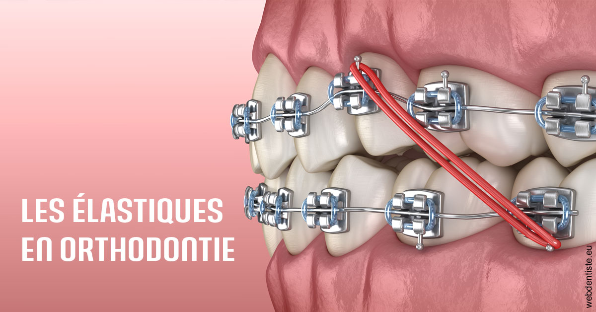 https://dr-rohr-marc.chirurgiens-dentistes.fr/Elastiques orthodontie 2