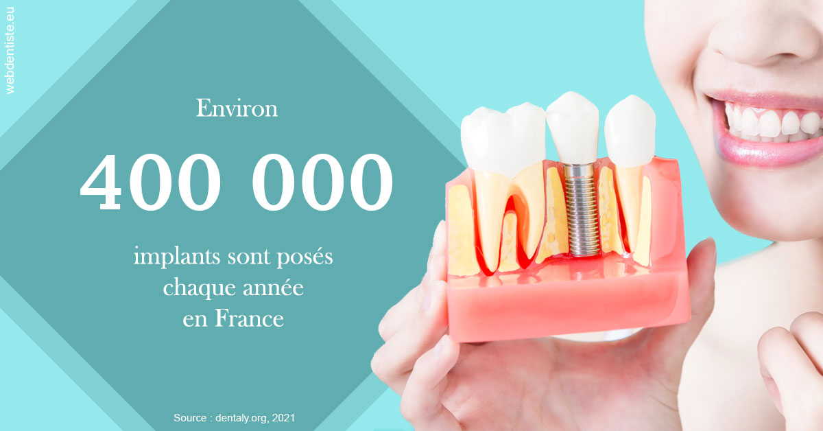 https://dr-rohr-marc.chirurgiens-dentistes.fr/Pose d'implants en France 2